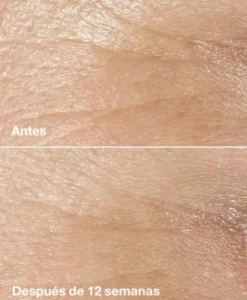 Clinique Smart Clinical Repair Wrinkle Correcting