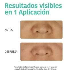 Iroha Detox Tiras Limpieza Puntos Negros